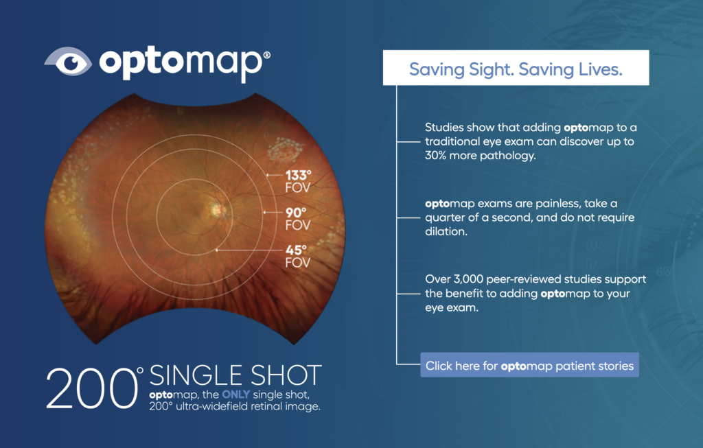 optomap 200 - single shot